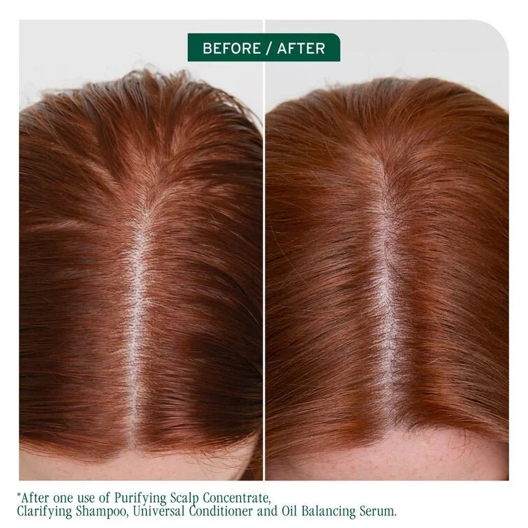 Biolage Scalp Sync Clarifying Shampoo 400ml - Image 6