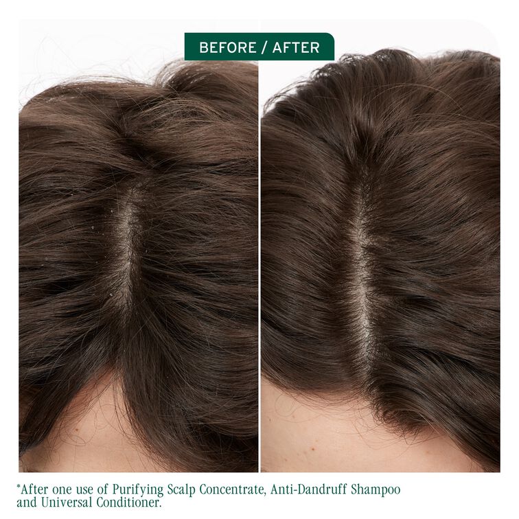 Biolage Scalp Sync Purifying Scalp Concentrate 200ml - Image 10