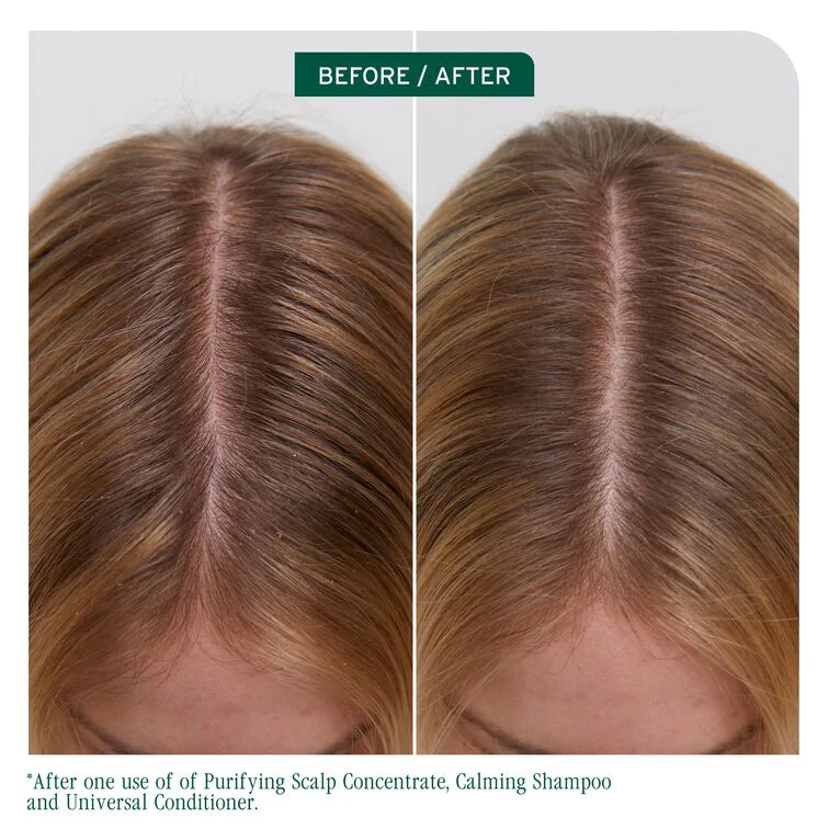 Biolage Scalp Sync Purifying Scalp Concentrate 200ml - Image 9