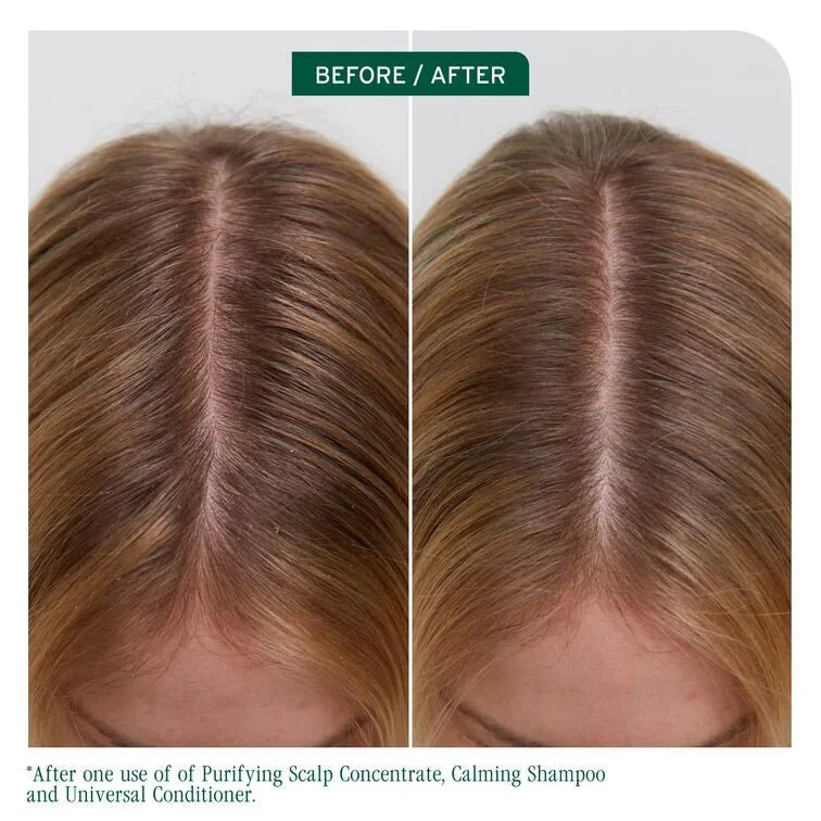 Biolage Scalp Sync Universal Conditioner 236ml - Image 4