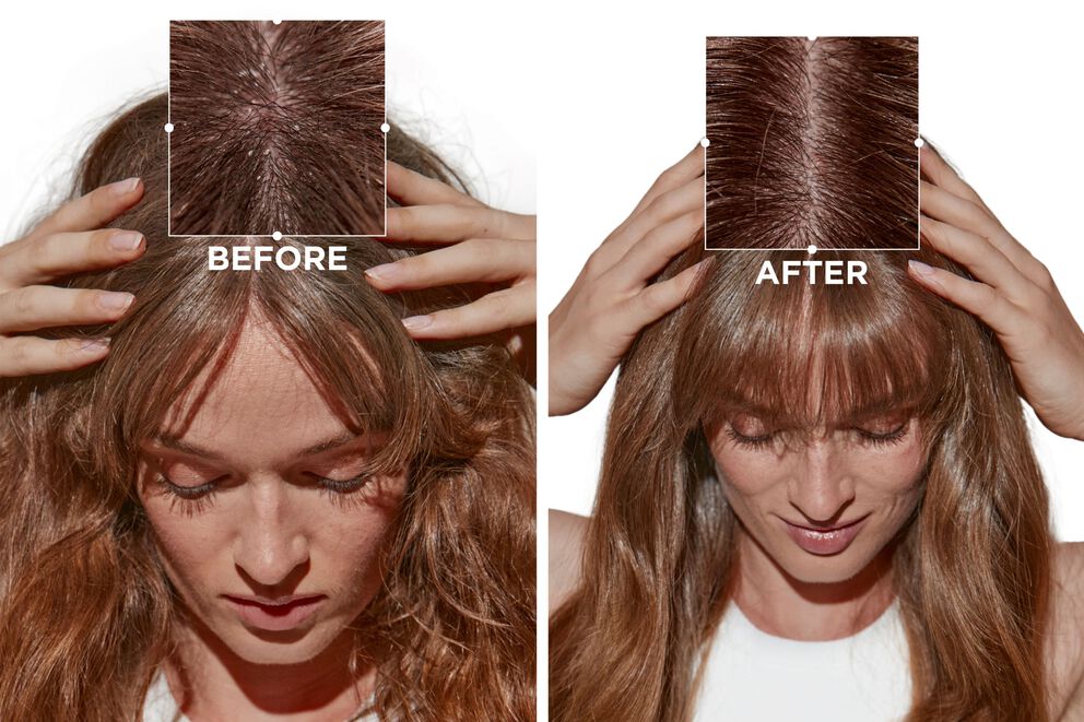 Kérastase Symbiose Cellulaire Nuit Anti-Dandruff Scalp Serum Intensif 30ml - Image 2