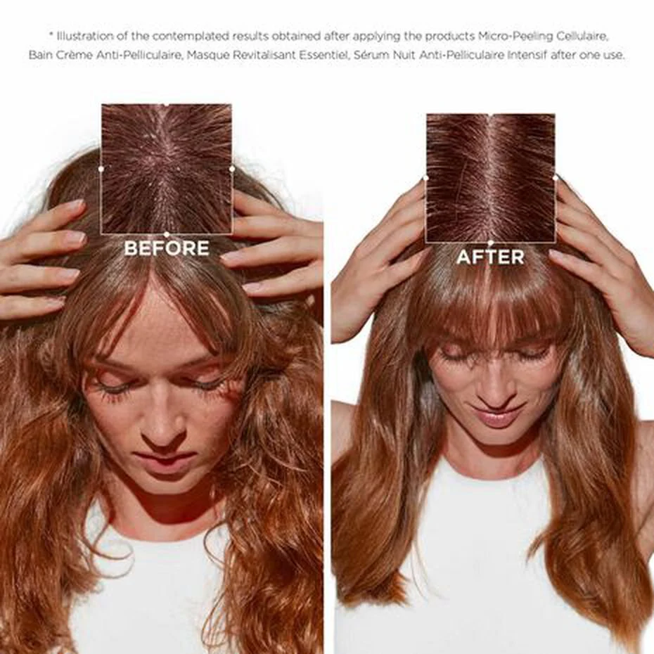 Kérastase Symbiose Serum Trio Bundle - Image 4