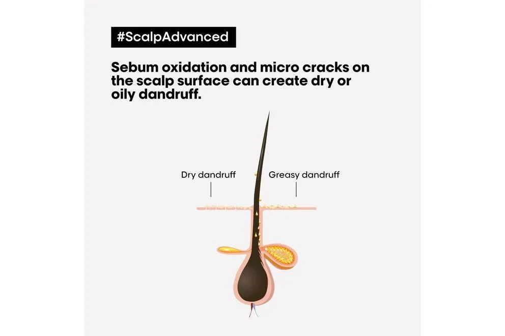 L'Oréal Professionnel Scalp Advanced Anti-Dandruff Shampoo 300ml - Image 4