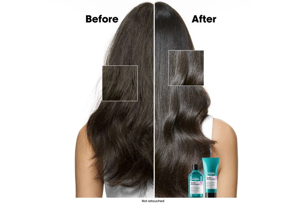 L'Oréal Professionnel Scalp Advanced Anti-Discomfort Shampoo 300ml - Image 3