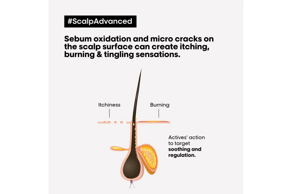 L'Oréal Professionnel Scalp Advanced Anti-Discomfort Treatment 200ml - Image 3