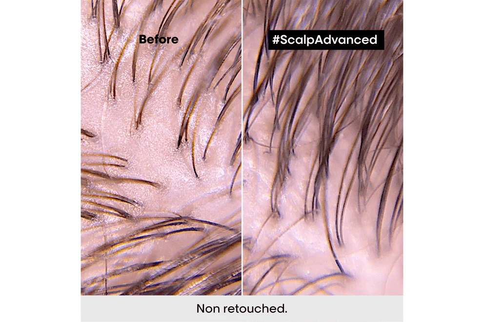 L'Oréal Professionnel Scalp Advanced Anti-Oiliness Mask 250ml - Image 6