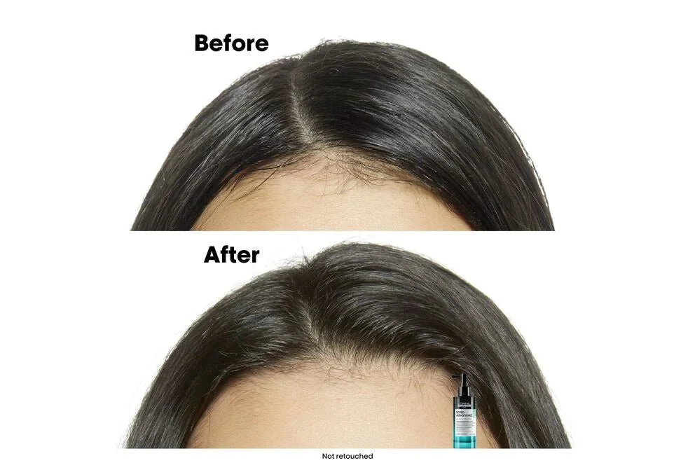 L'Oréal Professionnel Scalp Advanced Anti-Oiliness Serum 90ml - Image 3