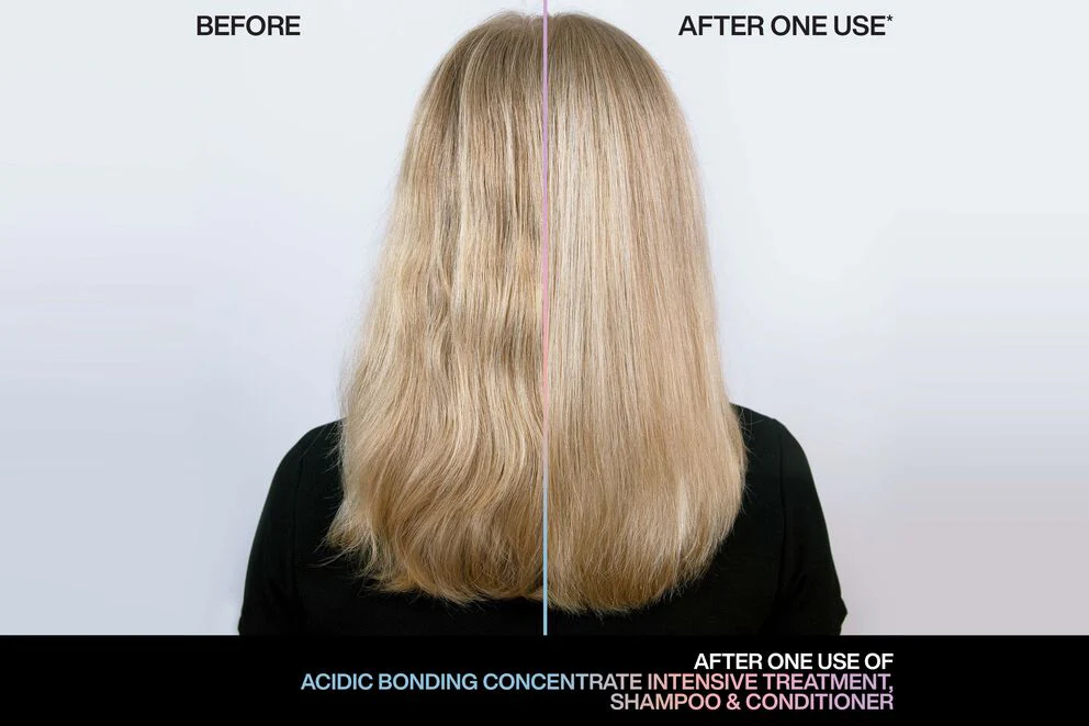 Redken Acidic Bonding Concentrate Intensive Treatment 150ml - Image 2